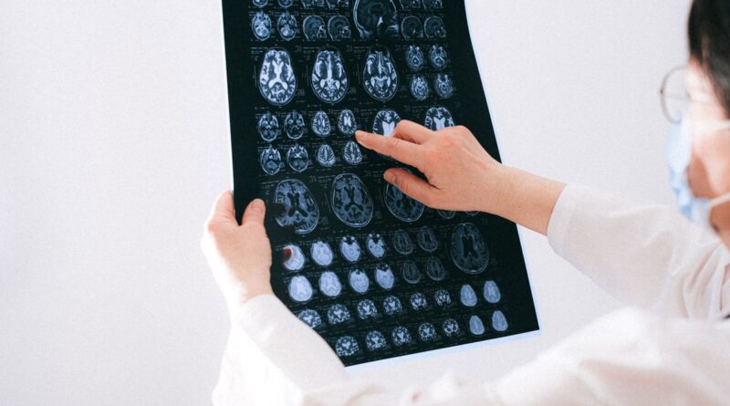 AI diagnostic demență